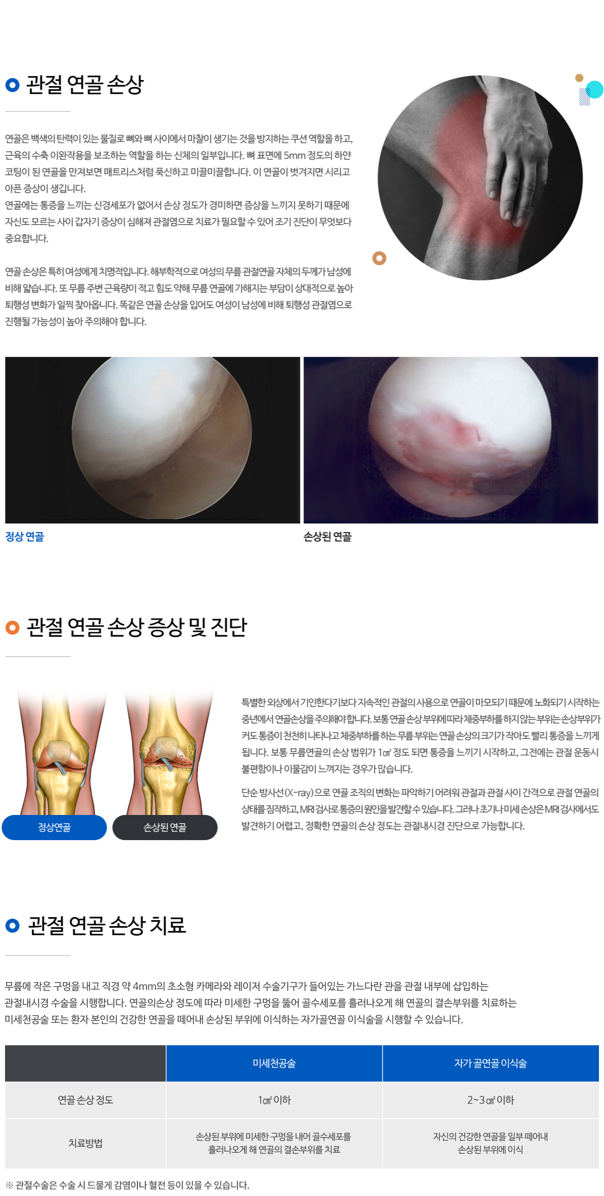 관절 연골 손상