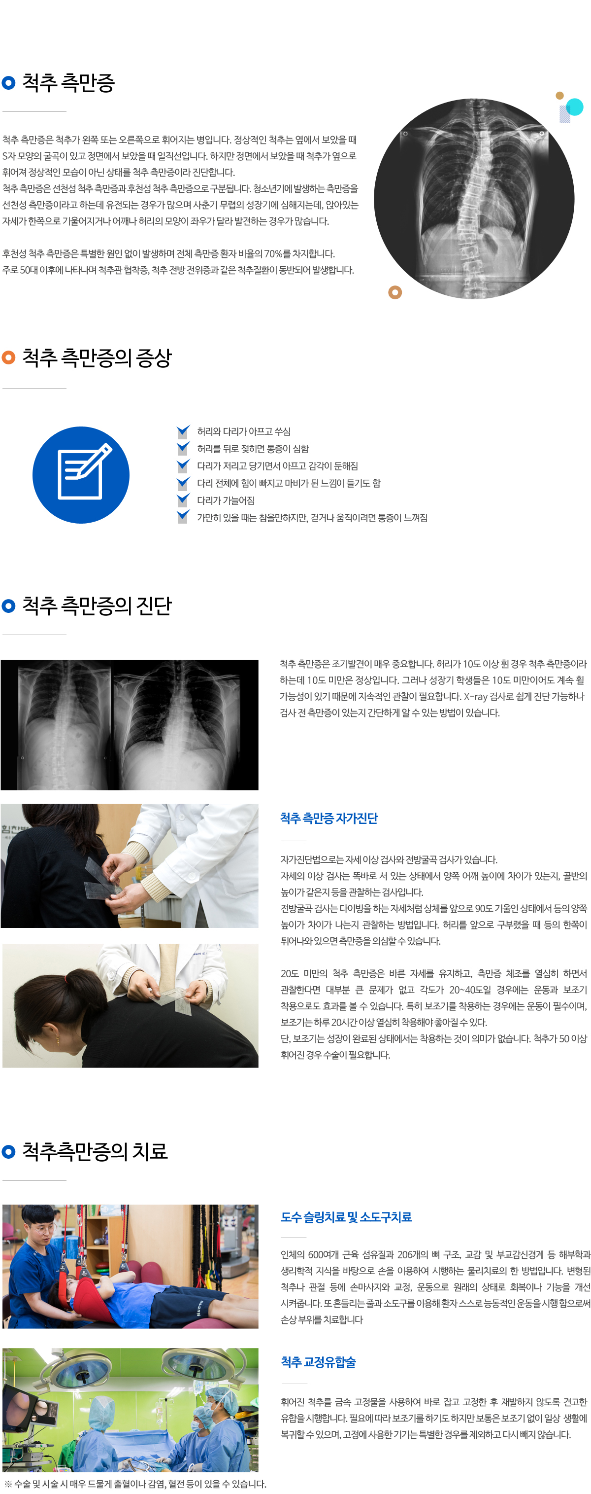 척추 측만증