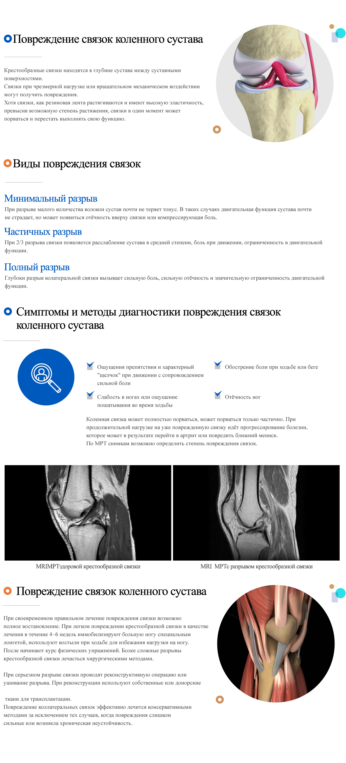 Knee ligament damage