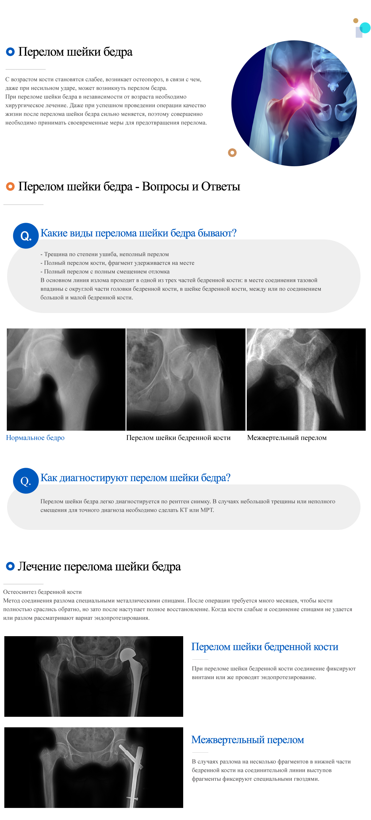 Hip fracture