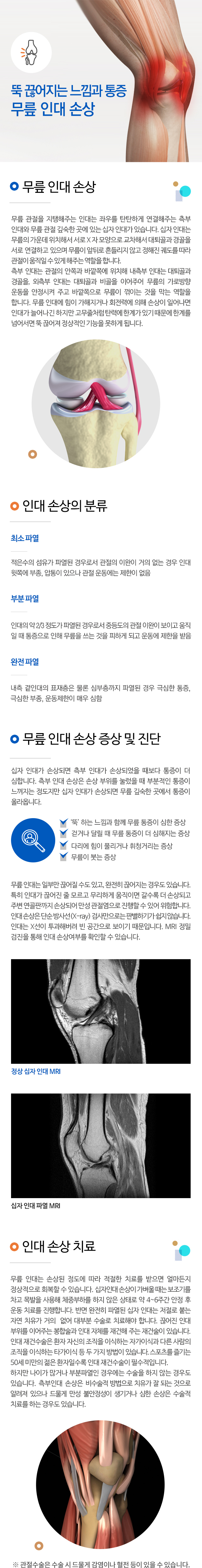 무릎 인대 손상