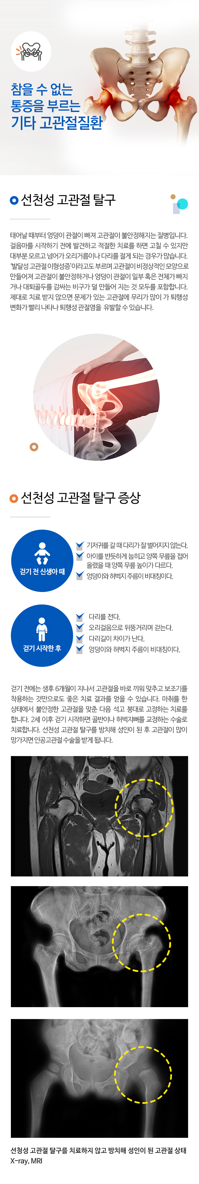 기타질환