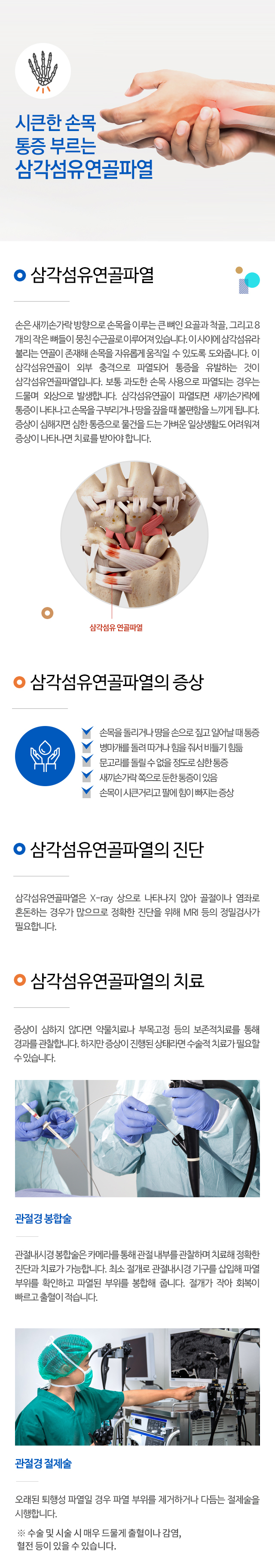 삼각섬유연골파열