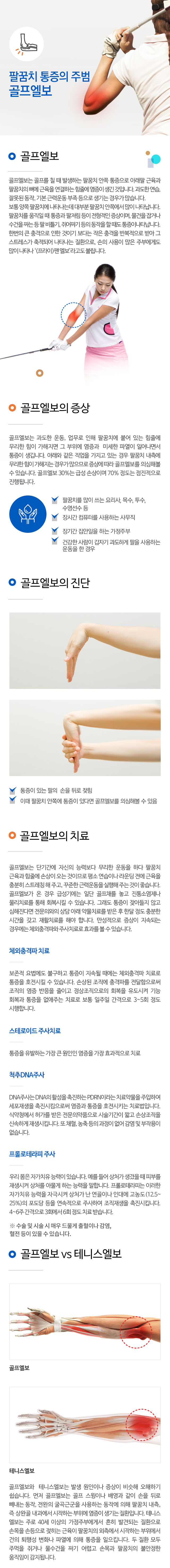 골프엘보