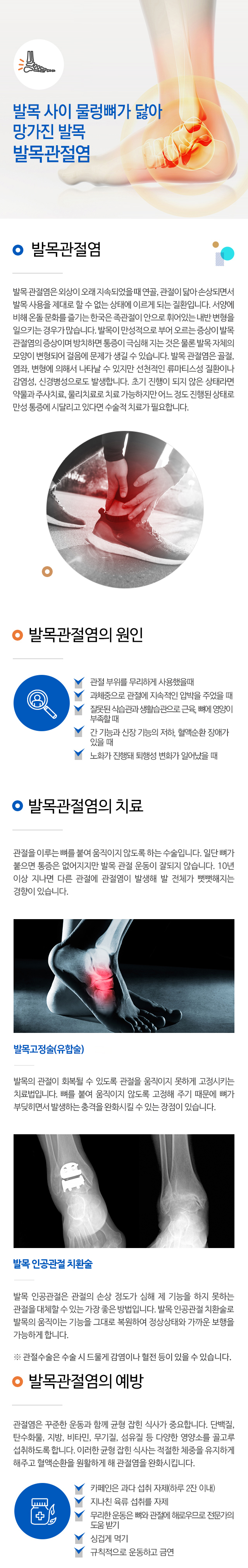 발목관절염