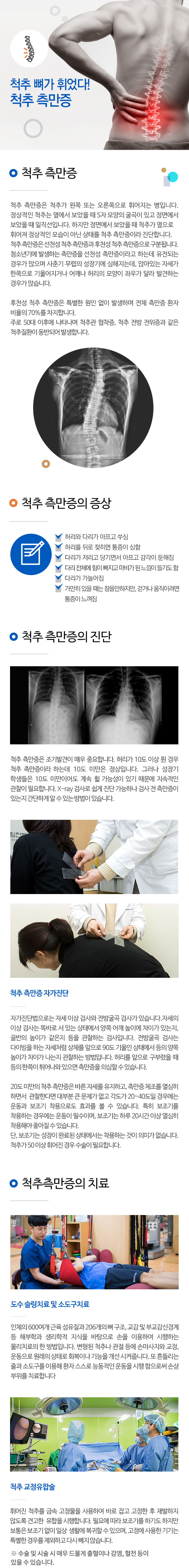 척추 측만증