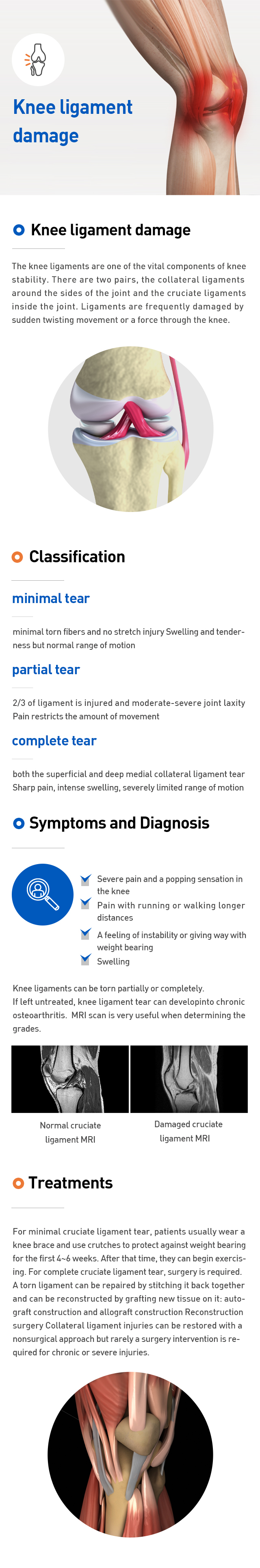 Knee ligament damage