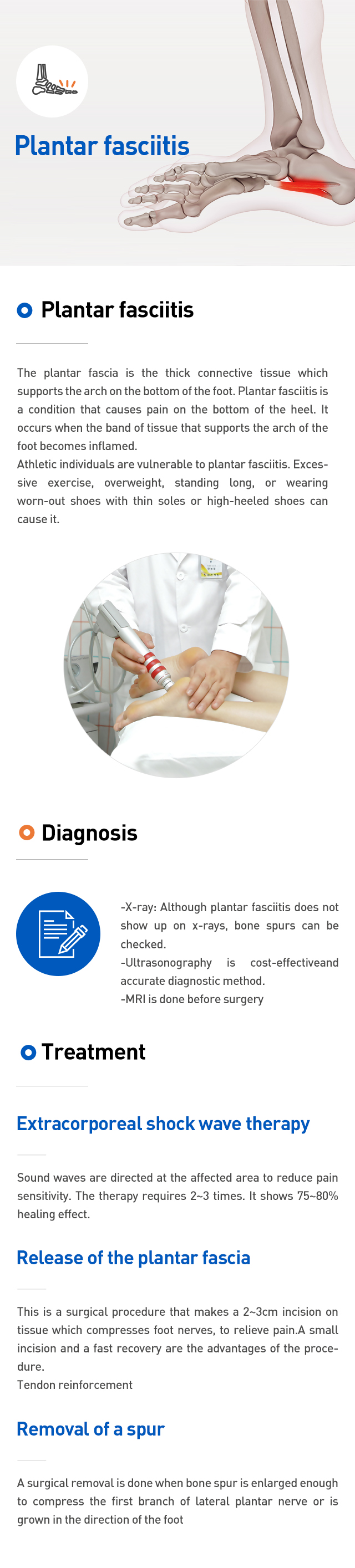 Plantar fasciitis