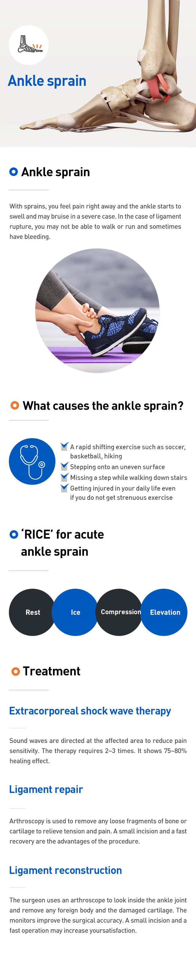 Ankle sprain