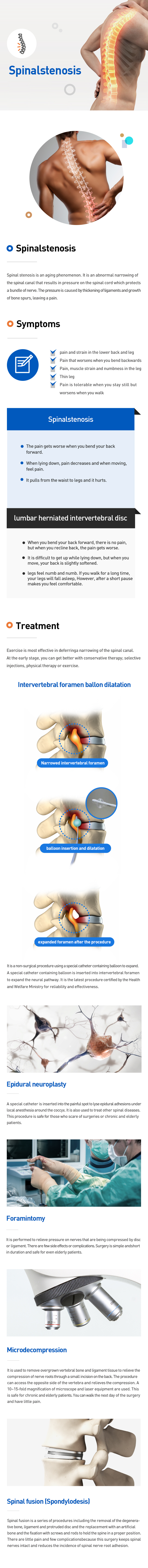 Spinalstenosis