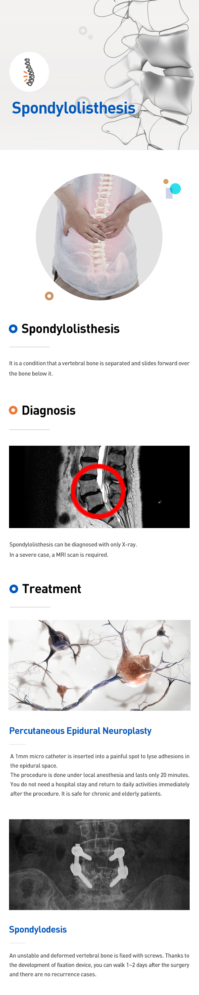 Spondylolisthesis