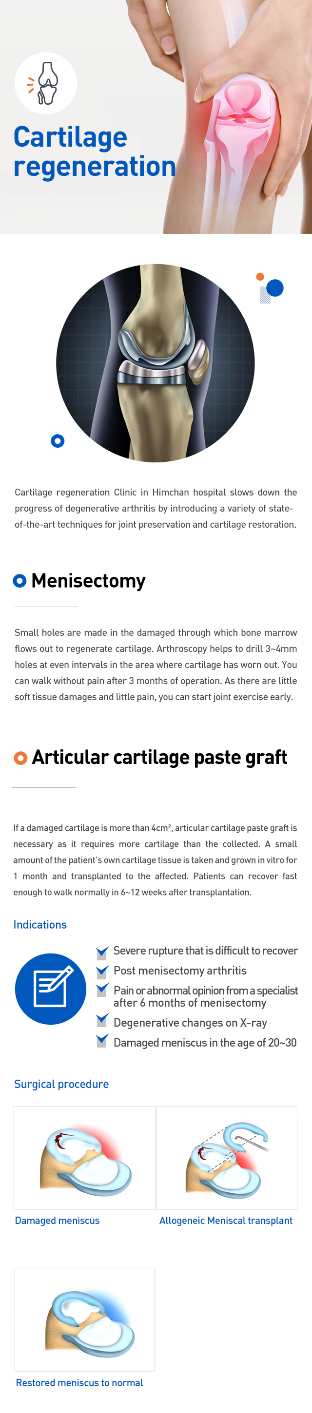 Cartilage regeneration