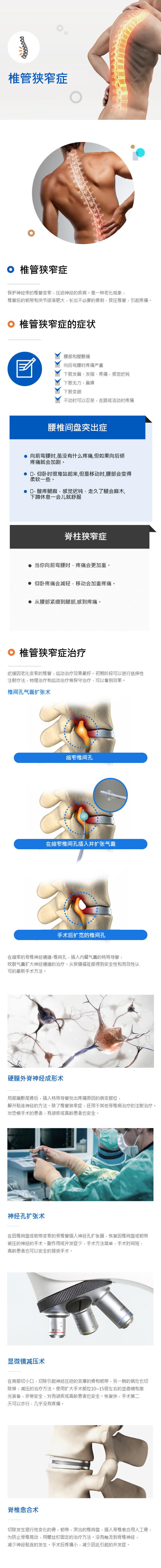 Spinalstenosis