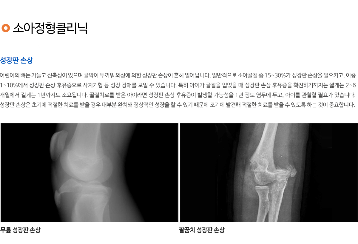 소아정형외과