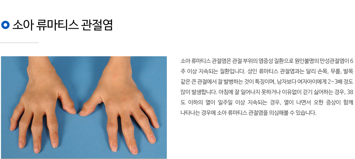 소아정형외과