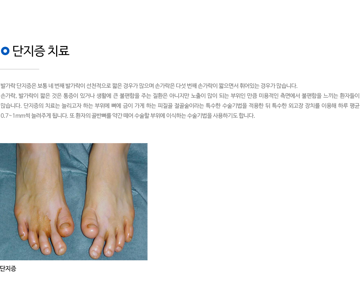 기형교정
