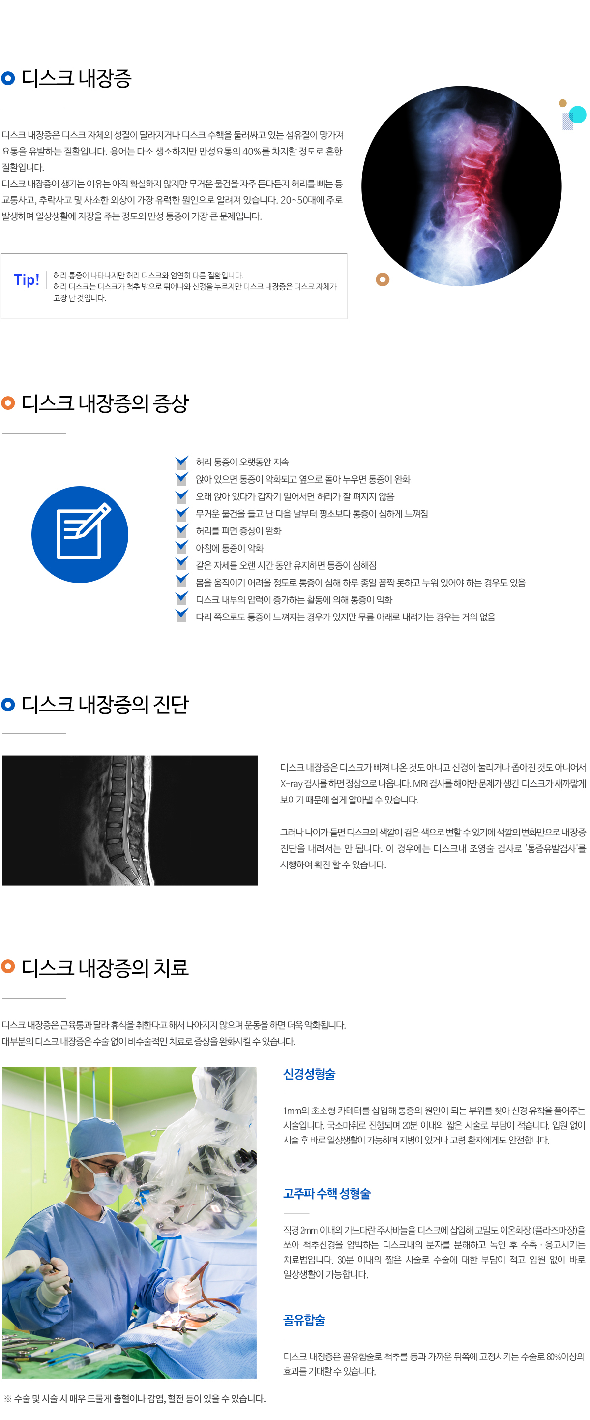 디스크내장증