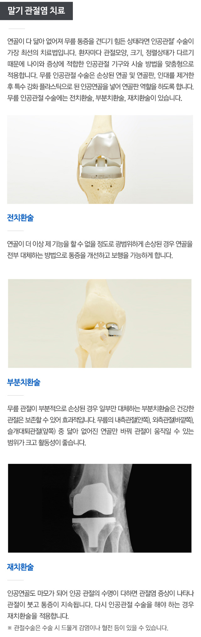 퇴행성 관절염