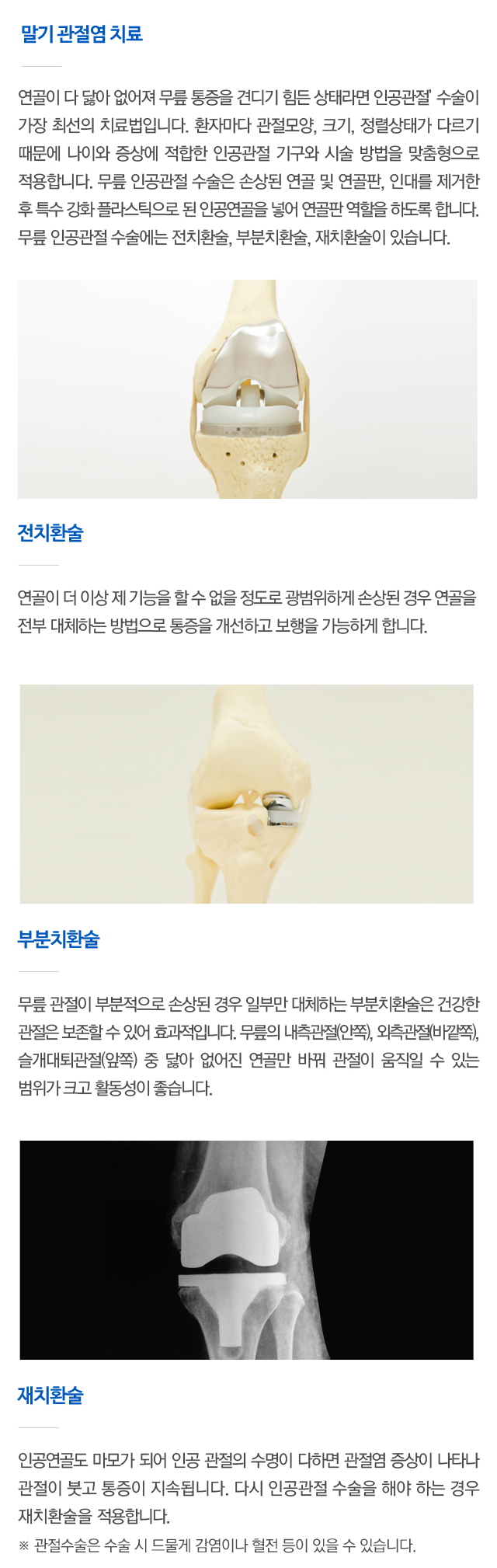 퇴행성 관절염