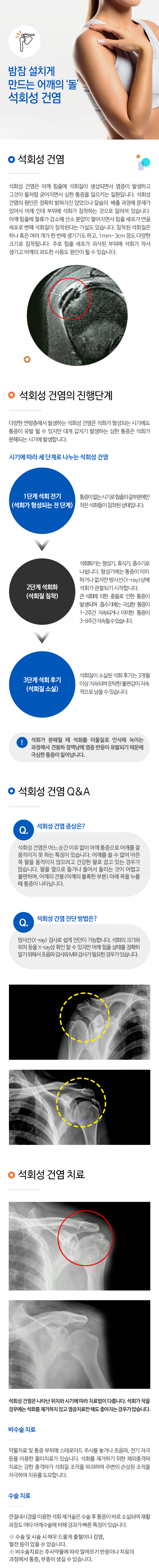 석회성 건염