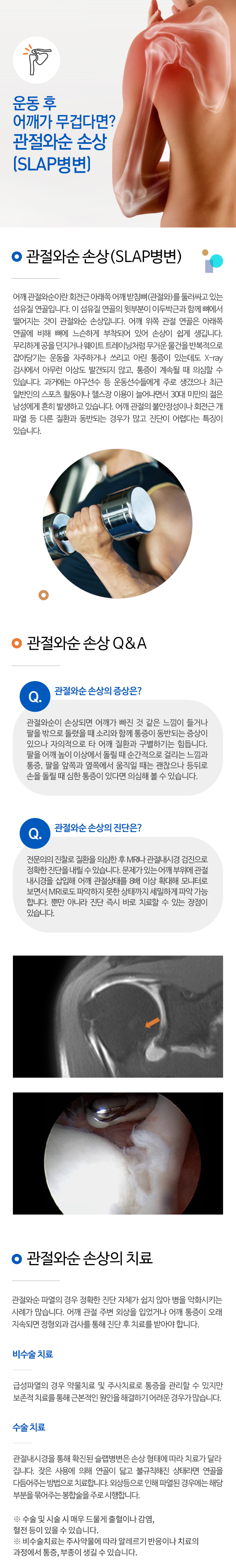 관절와순 손상