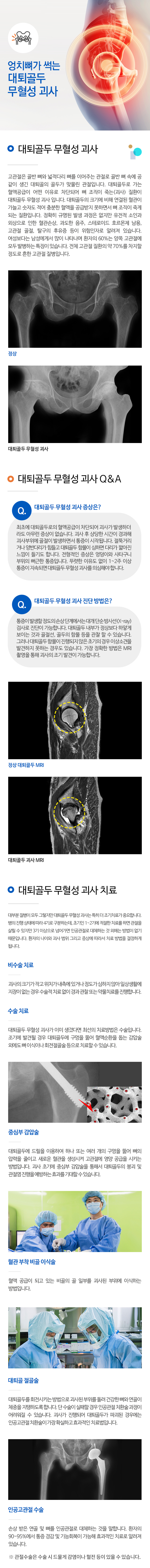 대퇴골두 무혈성 괴사