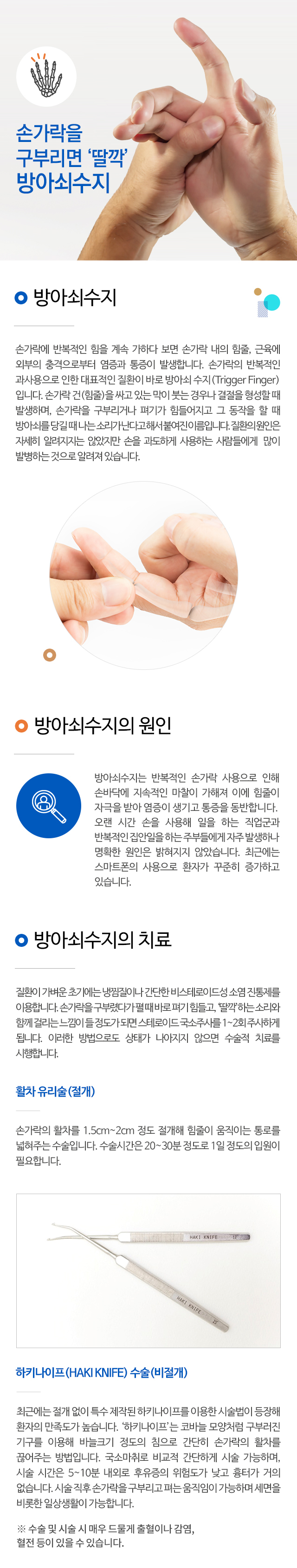 방아쇠수지