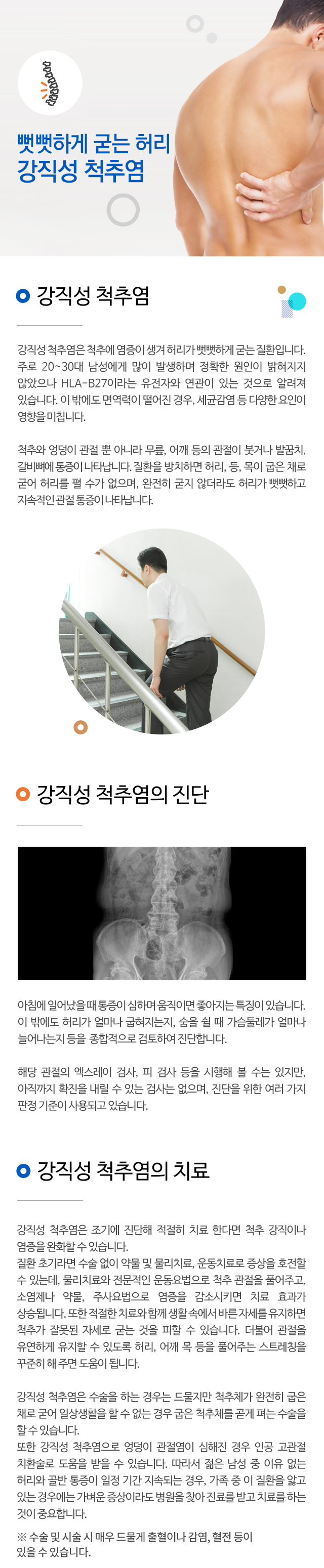 강직성 척추염