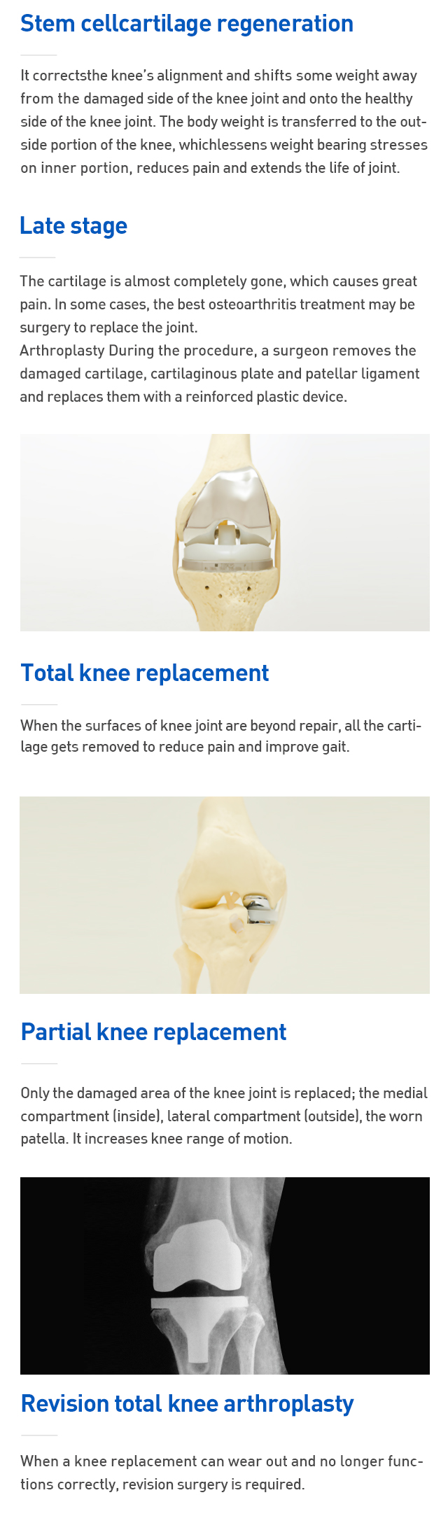 Degenerative arthritis