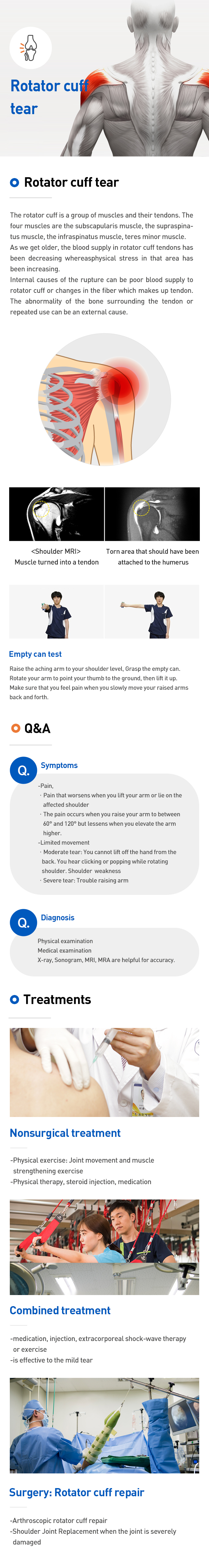 Rotator cuff tear