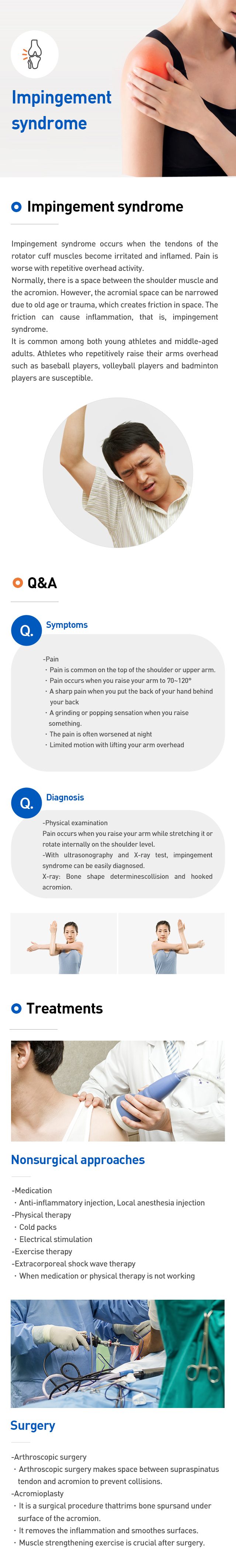 Impingement syndrome