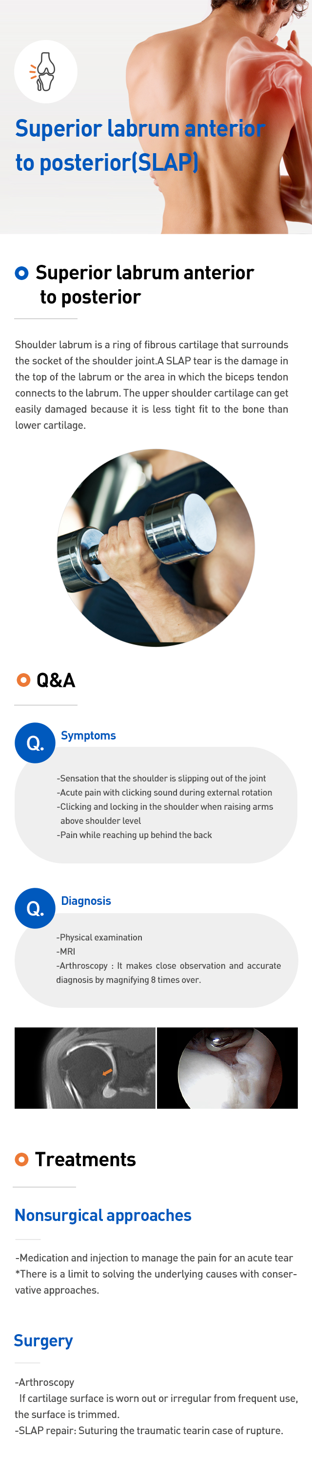 Superior labrum snterior to posterior