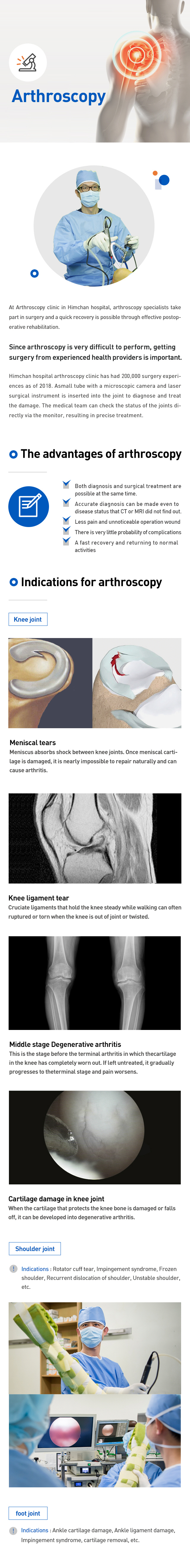 Arthroscopy