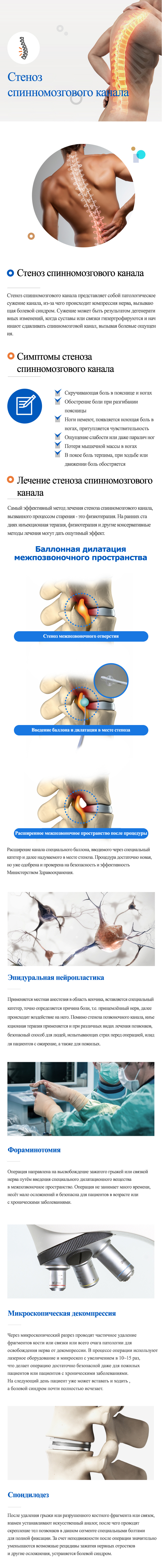 Spinalstenosis