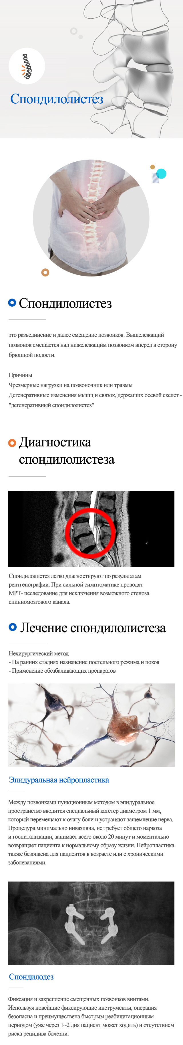 Spondylolisthesis