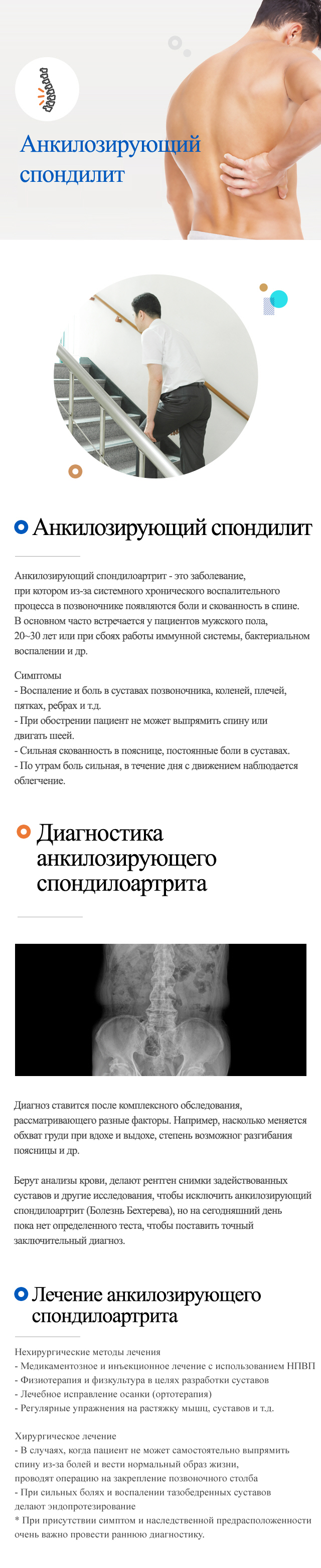 Заболевания позвоночника > Поясница > Анкилозирующий спондилоартрит