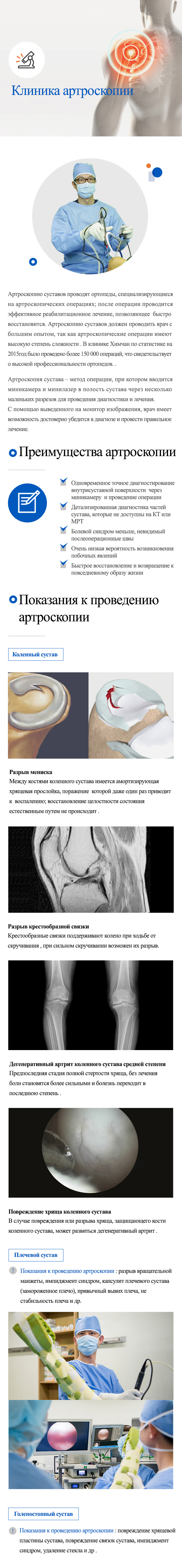 Arthroscopy