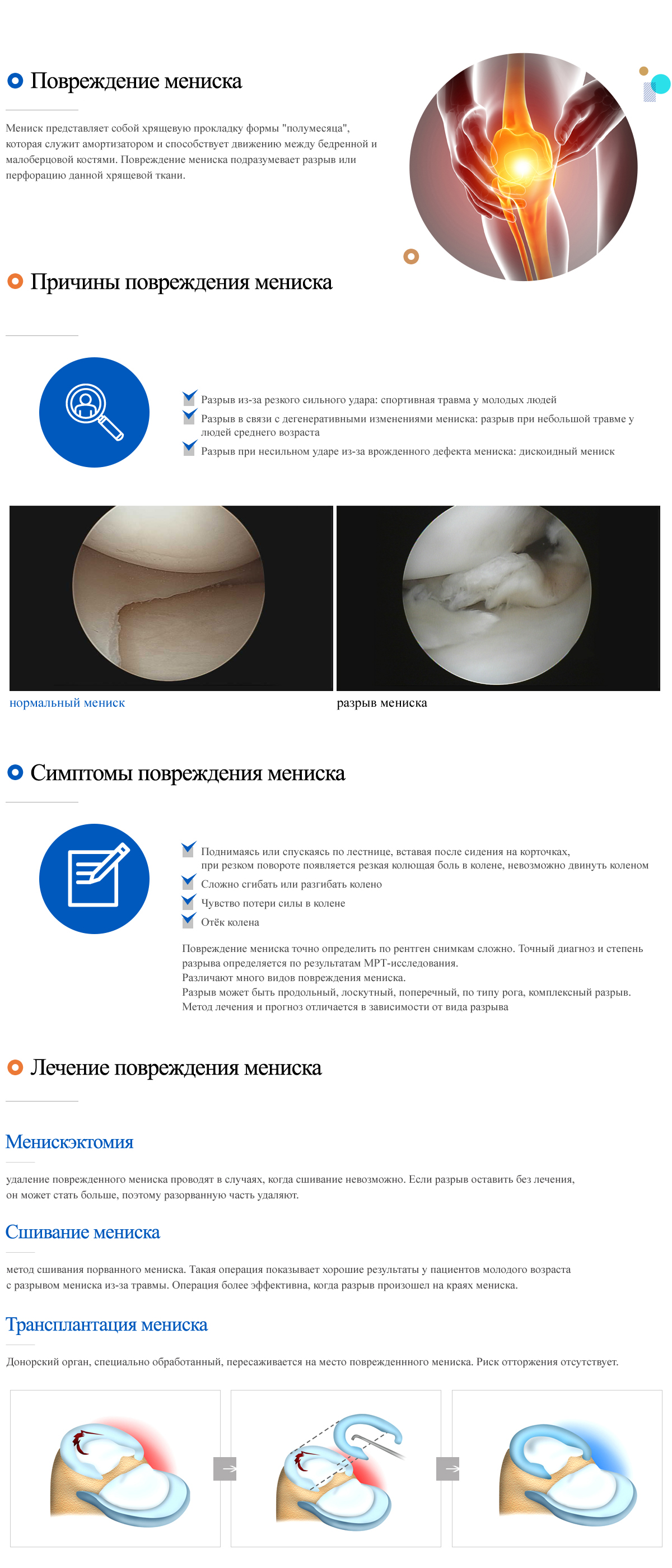 Meniscus damage