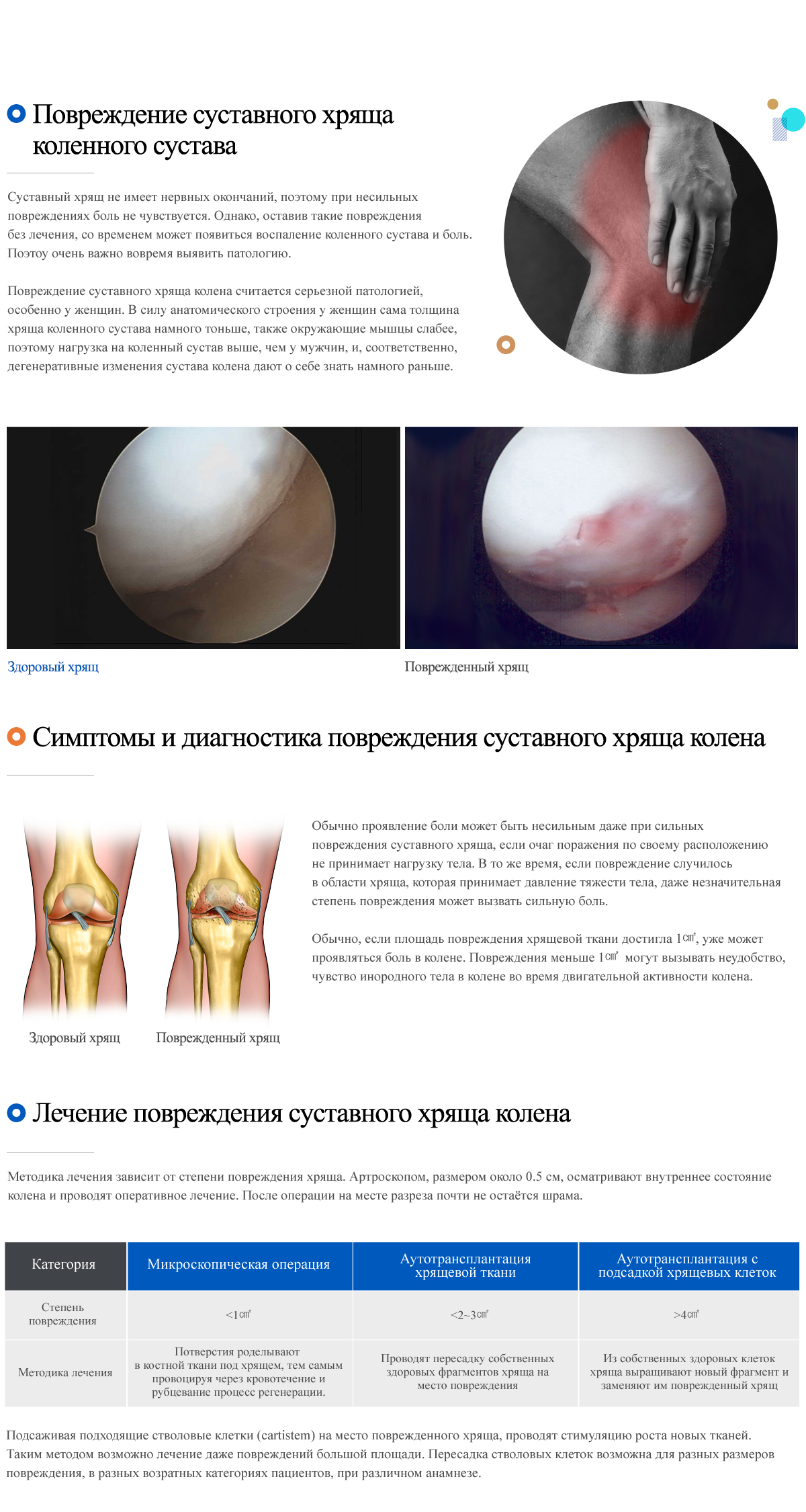 Articular cartilage damage